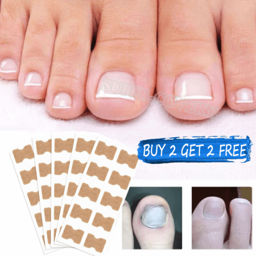50x Glue Free Toenail Toe Ingrown Nail Correction Patch Sticker Foot Care UK